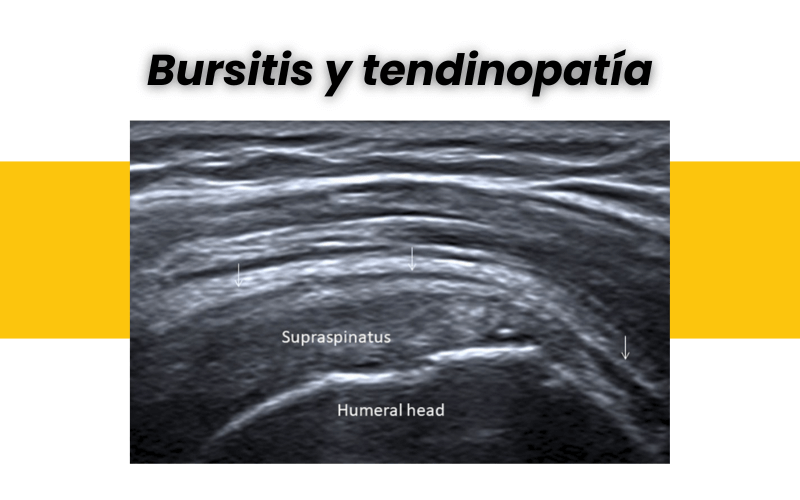 13. Lesiones ecografia genero tempo formacion.png